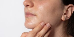 fotografia do rosto de uma pessoa com pele oleosa